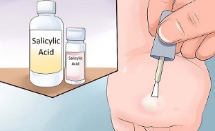 How to get rid of papilloma with folk methods