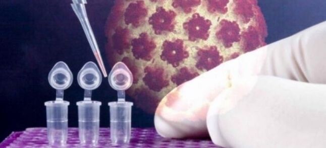 HPV Diagnosis Using Dual Genetic Testing